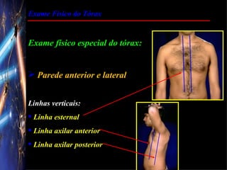 Exame Físico do Tórax


Exame físico especial do tórax:


 Parede anterior e lateral


Linhas verticais:
 Linha esternal
 Linha axilar anterior
 Linha axilar posterior
 