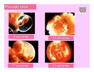 Período fetal




    9 semanas    13 semanas




    17 semanas   21 semanas
 