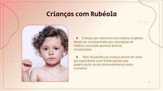 Crianças com Rubéola
⧫ Crianças que nasceram com rubéola congênita
devem ser acompanhadas por uma equipe de
médicos, pois pode aparecer diversas
complicações.
⧫ Além do pediatra as crianças devem ser vistas
por especialistas e por fisioterapeutas que
podem ajudar no seu desenvolvimento motor
e cerebral.
 