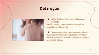 Definição
⧫ A Rubéola também conhecida como
sarampo
alemão é uma doença infecto-contagiosa
causada pelo Togavírus.
⧫ Sua característica mais marcante são as
manchas vermelhas que aparecem primeiro
na face e atrás da orelha e depois se espalham
pelo corpo inteiro.
 