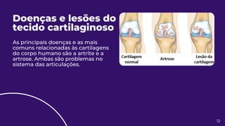 Doenças e lesões do
tecido cartilaginoso
As principais doenças e as mais
comuns relacionadas às cartilagens
do corpo humano são a artrite e a
artrose. Ambas são problemas no
sistema das articulações.
12
 