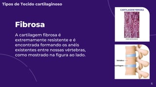 A cartilagem fibrosa é
extremamente resistente e é
encontrada formando os anéis
existentes entre nossas vértebras,
como mostrado na figura ao lado.
Fibrosa
6
Tipos de Tecido cartilaginoso
 