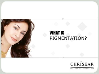 WHAT IS  PIGMENTATION? 