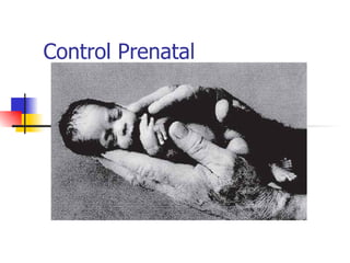Control Prenatal 