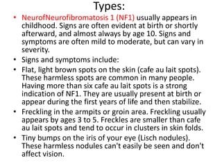 Nf1 Features Neurofibromatosis | PPTX