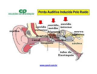 www.cpsol.com.br
Perda Auditiva Induzida Pelo Ruído
 