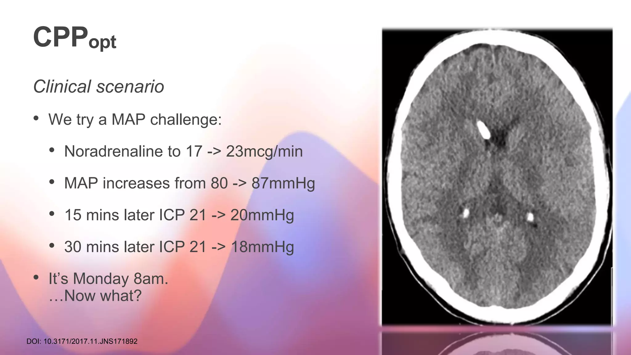 CPPopt
Clinical scenario
• We try a MAP challenge:
• Noradrenaline to 17 -> 23mcg/min
• MAP increases from 80 -> 87mmHg
• 15 mins later ICP 21 -> 20mmHg
• 30 mins later ICP 21 -> 18mmHg
• It’s Monday 8am.
…Now what?
DOI: 10.3171/2017.11.JNS171892
 