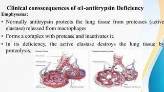 Clinical consscequences of α1-antitrypsin Deficiency
Emphysema:
• Normally antitrypsin protects the lung tissue from proteases (active
elastase) released from macrophages
• Forms a complex with protease and inactivates it.
• In its deficiency, the active elastase destroys the lung tissue by
proteolysis.
 