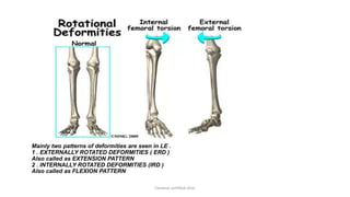 cerebral palsy and its orthotic management | PPTX
