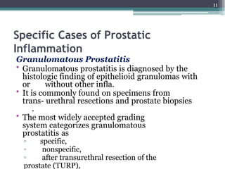 Specific Cases of Prostatic
Inflammation
Granulomatous Prostatitis
• Granulomatous prostatitis is diagnosed by the
histologic finding of epithelioid granulomas with
or without other infla.
• It is commonly found on specimens from
trans- urethral resections and prostate biopsies
.
• The most widely accepted grading
system categorizes granulomatous
prostatitis as
▫ specific,
▫ nonspecific,
▫ after transurethral resection of the
prostate (TURP),
11
 