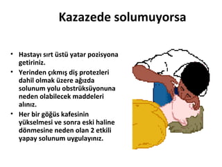 Kazazede solumuyorsa
• Hastayı sırt üstü yatar pozisyona
getiriniz.
• Yerinden çıkmış diş protezleri
dahil olmak üzere ağızda
solunum yolu obstrüksüyonuna
neden olabilecek maddeleri
alınız.
• Her bir göğüs kafesinin
yükselmesi ve sonra eski haline
dönmesine neden olan 2 etkili
yapay solunum uygulayınız.

 