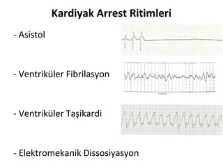 Kardiyak Arrest Ritimleri
- Asistol

- Ventriküler Fibrilasyon

- Ventriküler Taşikardi

- Elektromekanik Dissosiyasyon

 