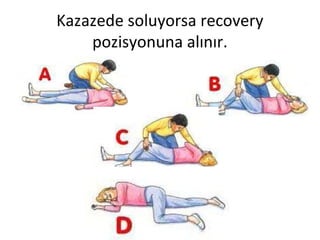 Kazazede soluyorsa recovery
pozisyonuna alınır.

 