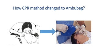 How CPR method changed to Ambubag?
 