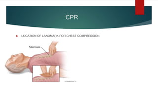 cardiopulmonary resuscitation | PPTX