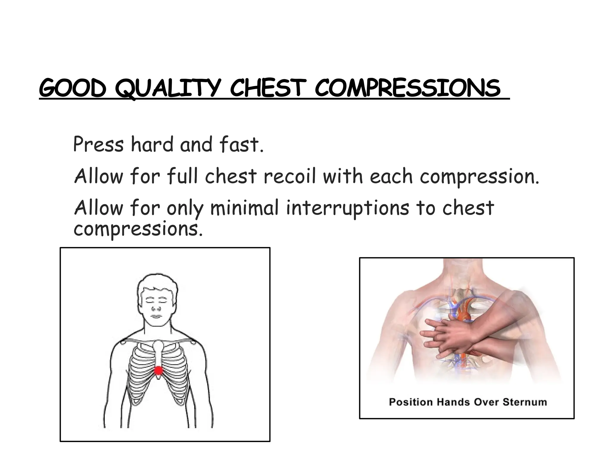 GOOD QUALITY CHEST COMPRESSIONS
Press hard and fast.
Allow for full chest recoil with each compression.
Allow for only minimal interruptions to chest
compressions.
 