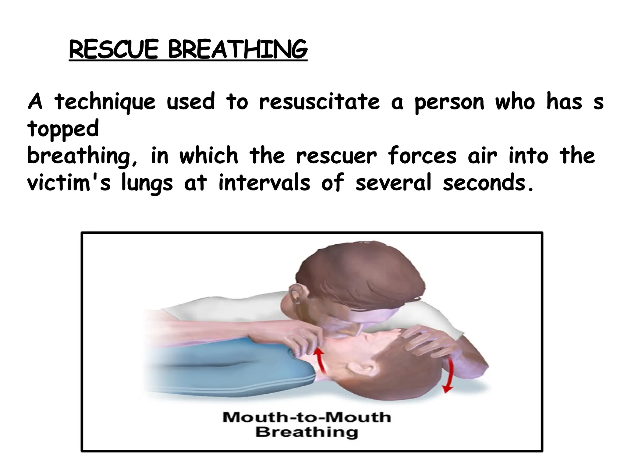 RESCUE BREATHING
A technique used to resuscitate a person who has s
topped
breathing, in which the rescuer forces air into the
victim's lungs at intervals of several seconds.
 