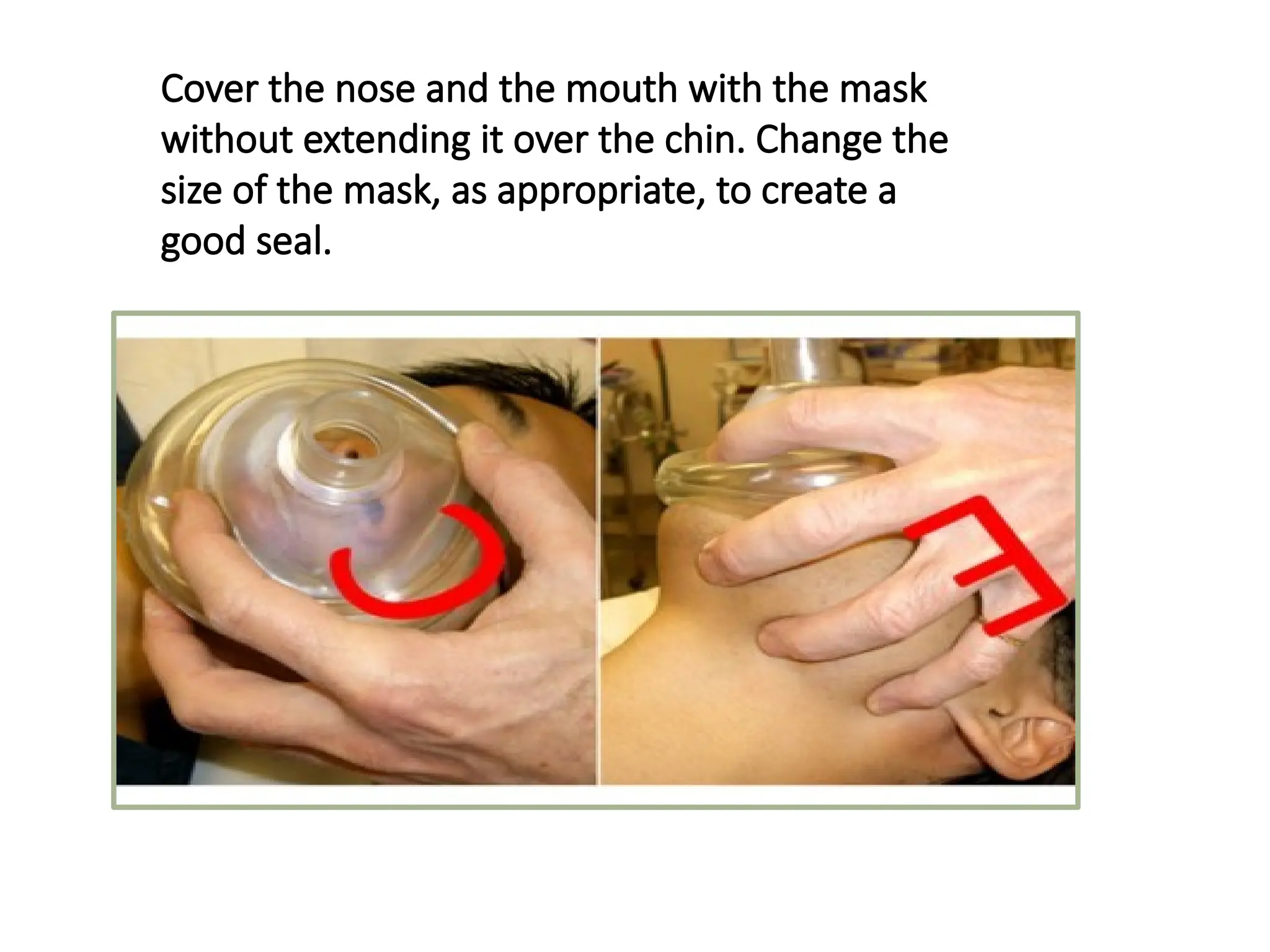 Cover the nose and the mouth with the mask
without extending it over the chin. Change the
size of the mask, as appropriate, to create a
good seal.
 