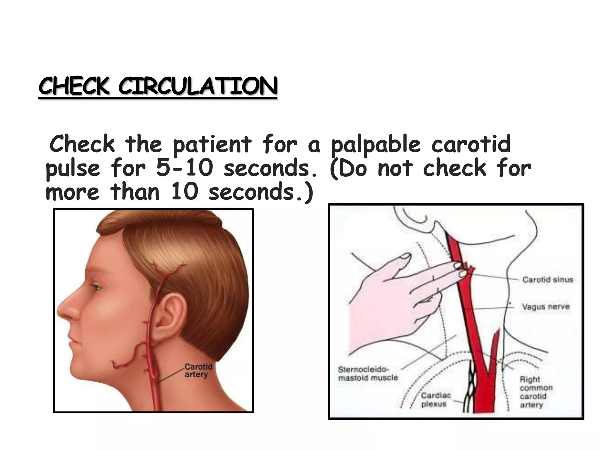 CHECK CIRCULATION
Check the patient for a palpable carotid
pulse for 5-10 seconds. (Do not check for
more than 10 seconds.)
 