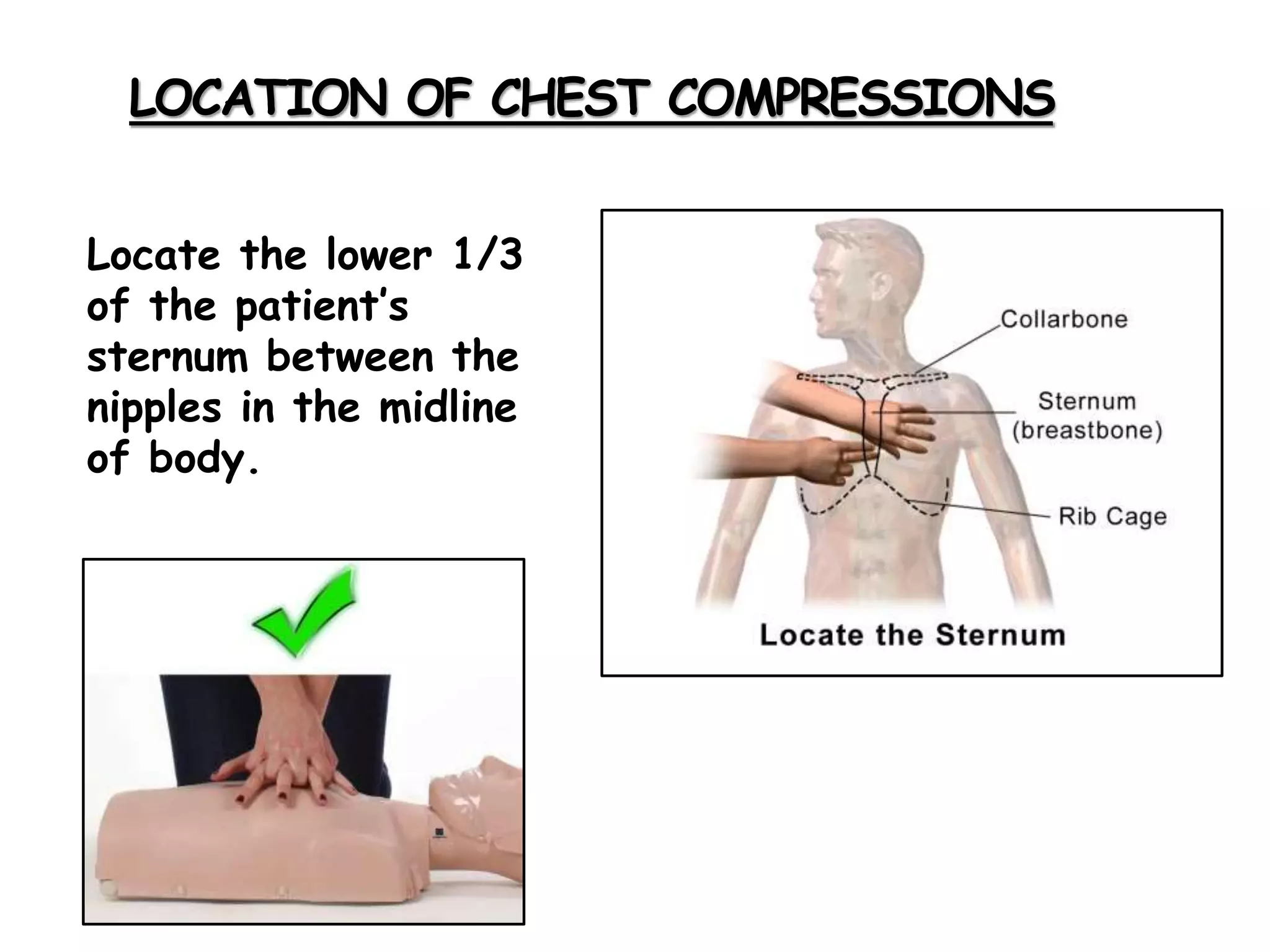 LOCATION OF CHEST COMPRESSIONS
Locate the lower 1/3
of the patient’s
sternum between the
nipples in the midline
of body.
 