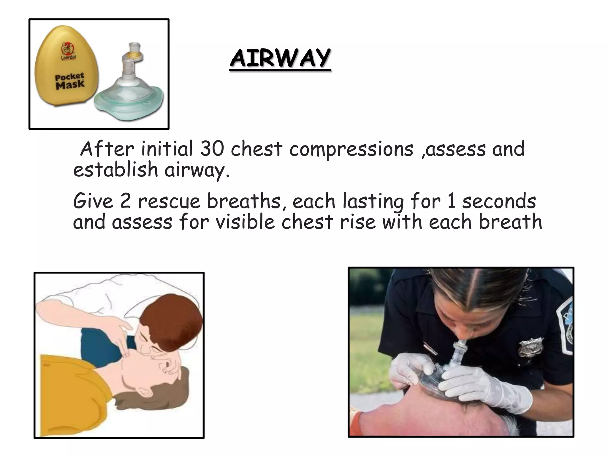 After initial 30 chest compressions ,assess and
establish airway.
Give 2 rescue breaths, each lasting for 1 seconds
and assess for visible chest rise with each breath
AIRWAY
 