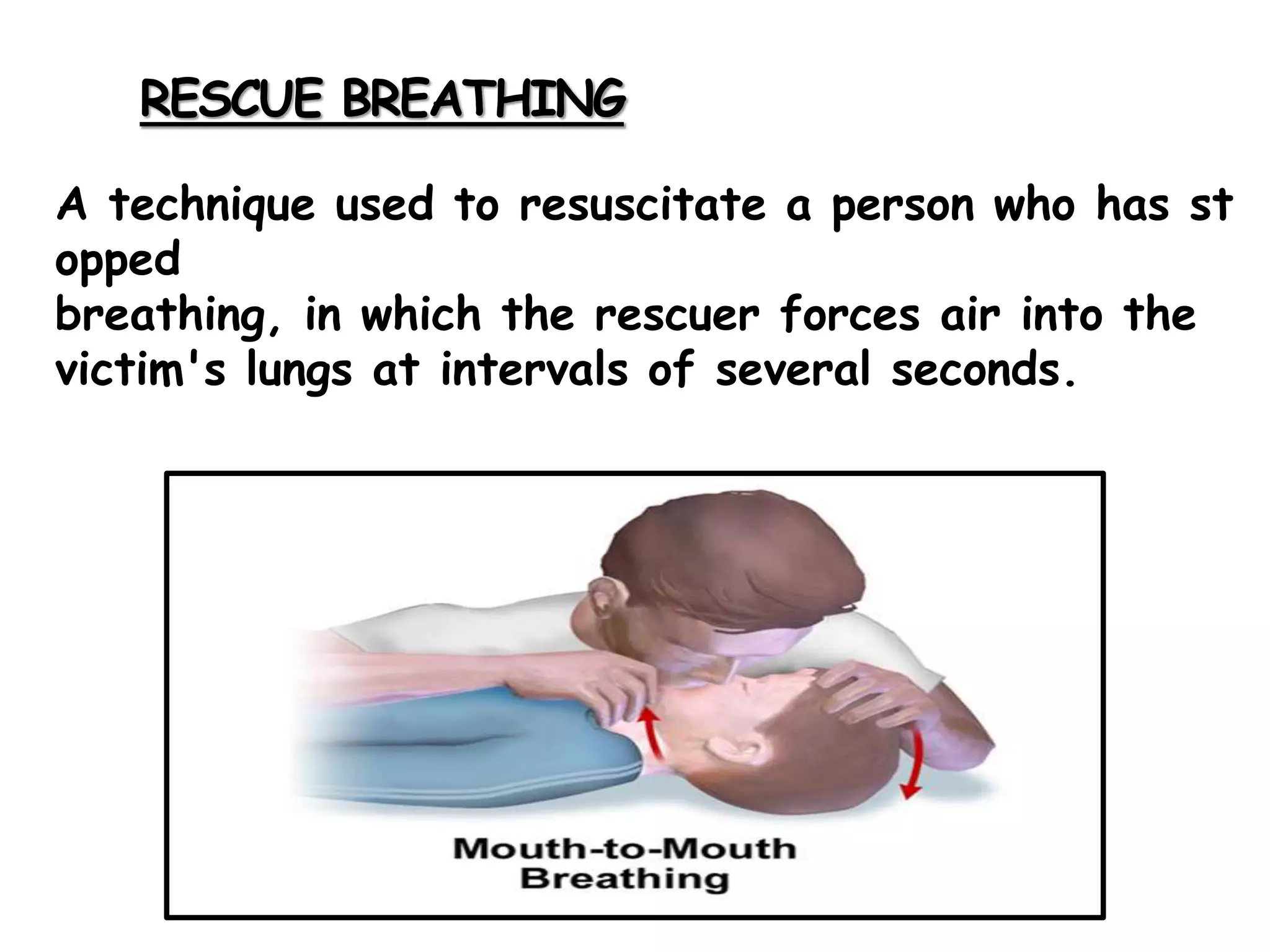 RESCUE BREATHING
A technique used to resuscitate a person who has st
opped
breathing, in which the rescuer forces air into the
victim's lungs at intervals of several seconds.
 