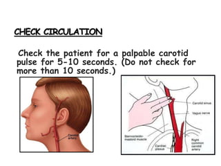 CHECK CIRCULATION
Check the patient for a palpable carotid
pulse for 5-10 seconds. (Do not check for
more than 10 seconds.)
 