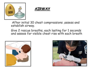 After initial 30 chest compressions ,assess and
establish airway.
Give 2 rescue breaths, each lasting for 1 seconds
and assess for visible chest rise with each breath
AIRWAY
 