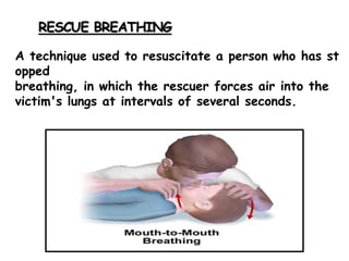 RESCUE BREATHING
A technique used to resuscitate a person who has st
opped
breathing, in which the rescuer forces air into the
victim's lungs at intervals of several seconds.
 