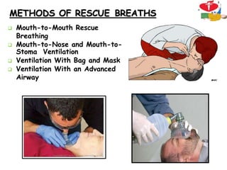 METHODS OF RESCUE BREATHS
 Mouth-to-Mouth Rescue
Breathing
 Mouth-to-Nose and Mouth-to-
Stoma Ventilation
 Ventilation With Bag and Mask
 Ventilation With an Advanced
Airway
32
 