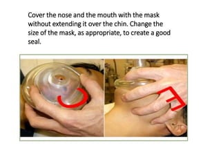 Cover the nose and the mouth with the mask
without extending it over the chin. Change the
size of the mask, as appropriate, to create a good
seal.
 