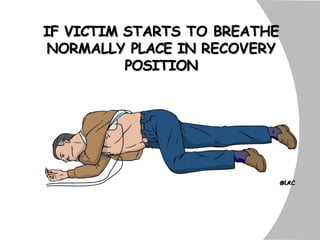 IF VICTIM STARTS TO BREATHE
NORMALLY PLACE IN RECOVERY
POSITION
 
