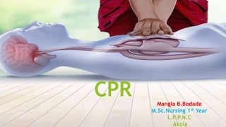 CPR Mangla B.Bodade
M.Sc.Nursing 1st Year
L.P.P.N.C
Akola
 