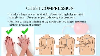 Sternal Compression CPR.pptx