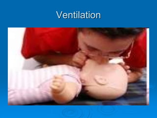 Ventilation
 
