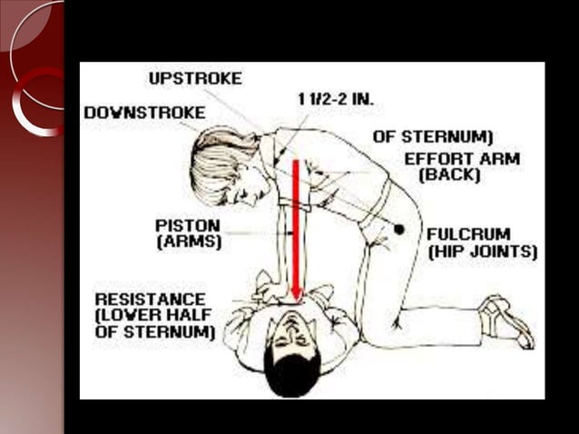 cardiopulamonary resuscitation presentation | PPT