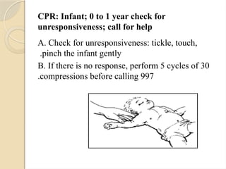 CPR: Infant; 0 to 1 year check for
unresponsiveness; call for help
A. Check for unresponsiveness: tickle, touch,
pinch the infant gently
.
B. If there is no response, perform 5 cycles of 30
compressions before calling 997
.
 