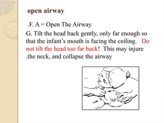 open airway
F. A = Open The Airway
.
G. Tilt the head back gently, only far enough so
that the infant’s mouth is facing the ceiling. Do
not tilt the head too far back! This may injure
the neck, and collapse the airway
.
 