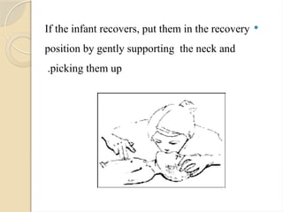
If the infant recovers, put them in the recovery
position by gently supporting the neck and
picking them up
.
 