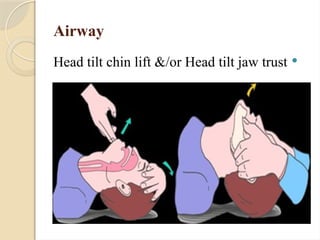 Airway

Head tilt chin lift &/or Head tilt jaw trust
 