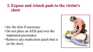 • dry the skin if necessary
• Do not place an AED pad over the
implanted pacemaker.
• Remove any medication patch that is
on the chest.
 