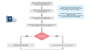 External
Defibrill
ator
 