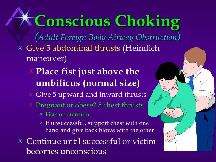 CPR - Saving Life adult umbilicus diagram 