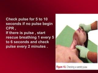 Cardiopulmonary resuscitation for children and adults | PPT