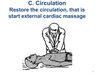 18
C. Circulation
Restore the circulation, that is
start external cardiac massage
 