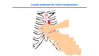 CPR 2020 Dewasa dan Bayi Dengan Materi Baik | PDF
