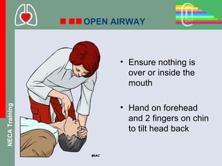 OPEN AIRWAY



                      • Ensure nothing is
                        over or inside the
                        mouth

                      • Hand on forehead
NECA Training




                        and 2 fingers on chin
                        to tilt head back
 