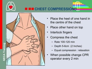 CHEST COMPRESSIONS

                     • Place the heel of one hand in
                       the centre of the chest
                     • Place other hand on top
                     • Interlock fingers
                     • Compress the chest
                        – Rate 100-120 min
NECA Training




                        – Depth 5-6cm (2 Inches)
                        – Equal compression : relaxation
                     • When possible change CPR
                       operator every 2 min
 