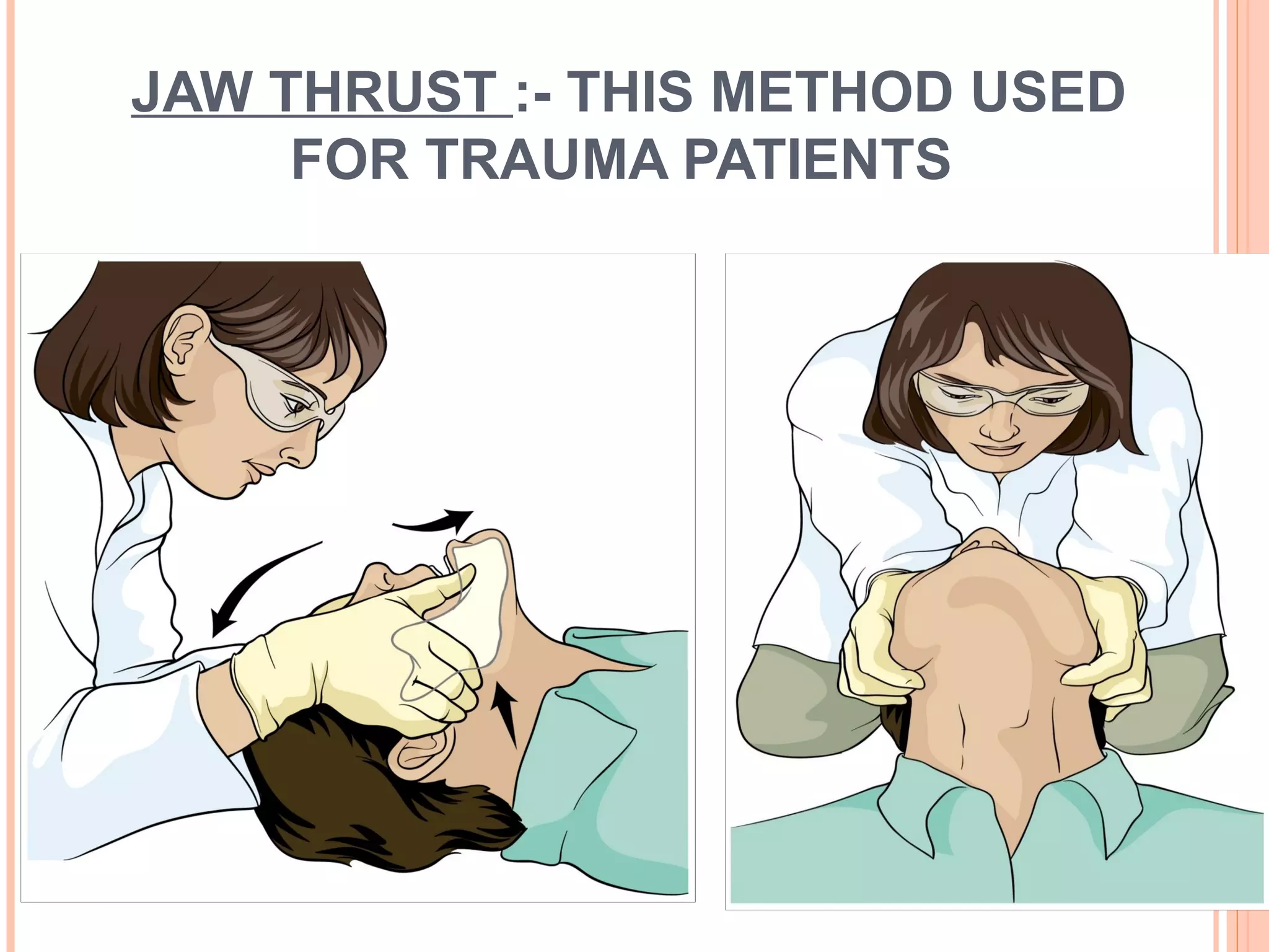 JAW THRUST :- THIS METHOD USED
FOR TRAUMA PATIENTS
 