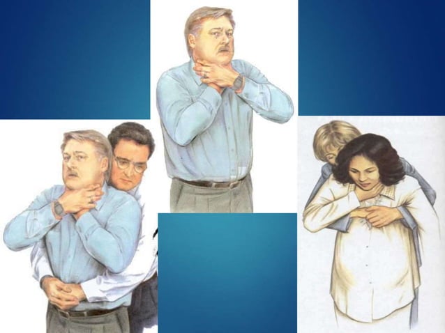 BASIC LIFE SUPPORT- BLS (CPR) -American Heart Association | PPT | First ...